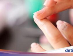 4 Perubahan Di Kuku yang Bisa Karena Itu Pertanda Penyakit, Jangan Diabaikan!