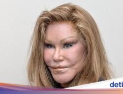 Sosialita Jocelyne Wildenstein Meninggal Pada Tidur Siang, Inikah Pemicunya?