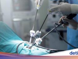 Cerita Para Ahli Kebugaran yang Mengoperasi Dirinya Sendiri, Ada yang Angkat Usus Buntu