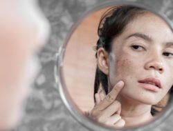 Kulit Susah Banget Glowing? Bisa Karena Itu Skin Barrier Rusak, Ini Saran Praktisi Medis