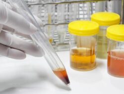 Warna Urine Ini Didalam Sebab Itu Tanda Sakit Ginjal, Segera Periksa Jika Mengalaminya