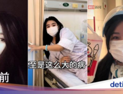 Idap Penyakit Ginjal Serius, Wanita Ini Tetap Semangat Karena Itu Pengantar Citarasa