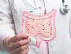 Warga RI Dihantui Penyakit Kanker Usus Besar, Ahli Kebugaran Ungkap Alasannya