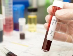 Curhat Istri 10 Tahun Tak Tahu Suaminya HIV, Terungkap Di Jenguk Di Penjara