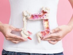 Praktisi Medis Beberkan Pemicu Sumbatan Usus yang Bisa Sebabkan Kematian