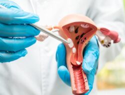 Cewek Perlu Tahu, Ini Masalah ‘Tersembunyi’ Di Rahim yang Bisa Ganggu Kesuburan