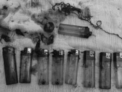 Bukan Photoshop, Penampakan Nyata 10 Korek Api Bersarang Di Perut Pasien