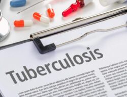 Pakar Singgung ‘Slow-Burn Epidemic’ TBC Ke Malaysia, Bisa Menular Diam-diam
