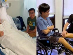 Pria Habiskan Rp 2,3 M Sebagai Operasi Tinggi Badan, Nggak PD Terlihat ‘Pendek’