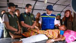 Menkes Kirim Praktisi Medis Ortopedi Di NTT, Tangani Pasien Patah Tulang Termasuk Usia Anak